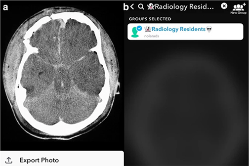 Snapchat radiology image